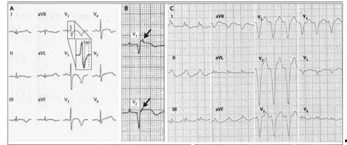 医院心电图拍照吃瓜网,揭秘医院里的“吃瓜”瞬间