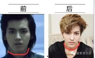 男网红整容脸吃瓜图片,吃瓜群众热议男网红变脸之谜